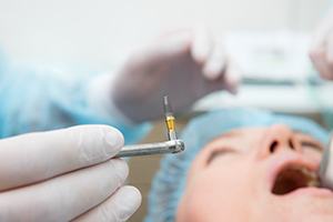 dentist holding dental implant during surgery 