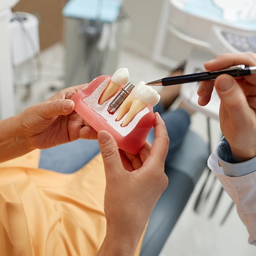 Dentist using model to explain dental implants