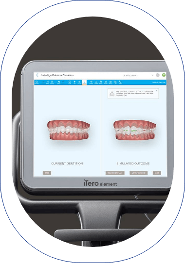 Woman holding invisalign aligners