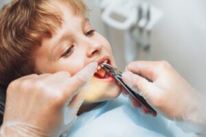 Little boy sitting in dentist’s chair having tooth extracted.
